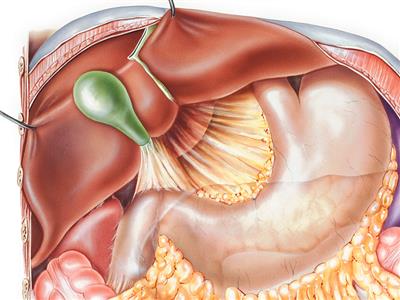 Nguyên nhân gây trào ngược dịch mật