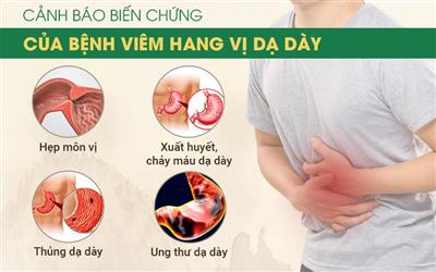 Bệnh Viêm Hang Vị Dạ Dày & Cách Chữa Hiệu Quả Nhât (NÊN BIẾT)